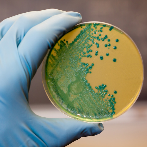 Cómo eliminar la Listeria