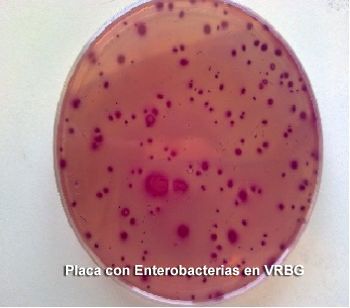 ASP detecta Staphylococcus y Enterobacterias en las manos de un tercio de los cocineros